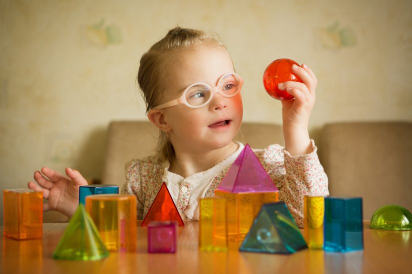 Down Syndrome Coexists In 18% Of Children Diagnosed With Autism